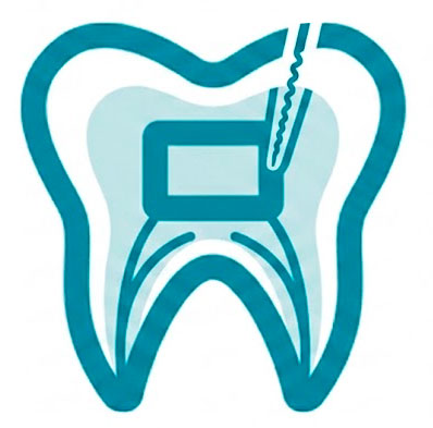 endodoncia en %wk_loc%